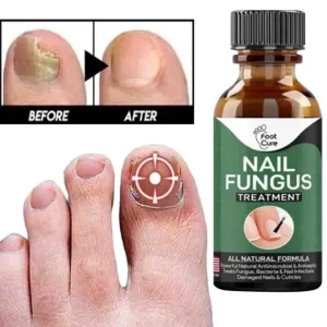 Fast Nail Fungal Treatments Nail Repair Gel