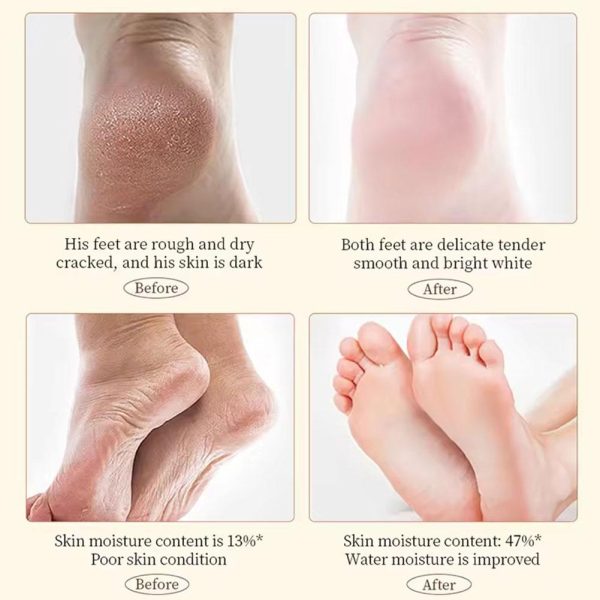 Skin Repair - Smooth Restore Feet Care Products